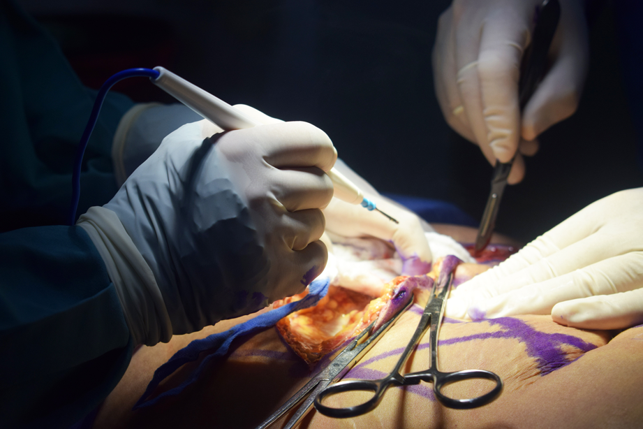 Mala Praxis Médica en Cirugías Estéticas