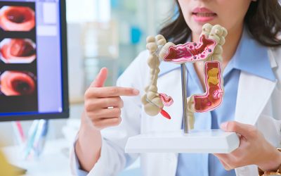 31 de marzo: Día Mundial contra el Cáncer de Colon | Un riesgo silencioso y prevenible